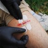 rhino-rescue-kit-cierre-de-heridas-704418_lynxgear